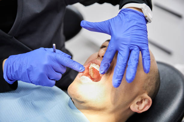 Best Emergency Dentist for Knocked-Out Tooth in Bellwood, PA